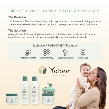 Eczema Scalp Support Babies